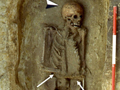 Замечен скелет средневекового итальянца с ножом вместо руки  