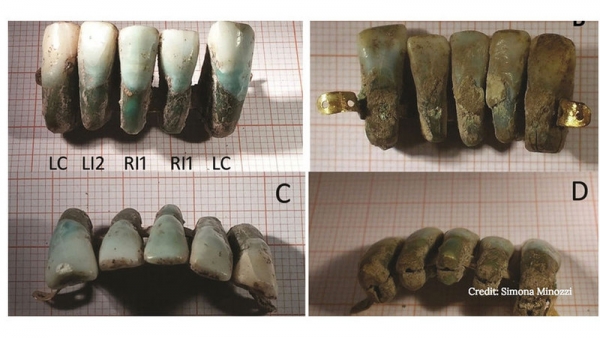 В итальянской гробнице отыскан зубной протез из пяти зубов 